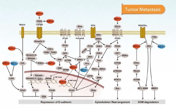 tumor metastasis
