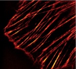 3D-SIM microscopy image of labeled Actin stress fibers in human primary dermal fibroblasts.