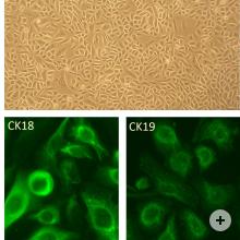 Top: Human Cervical Epithelial Cells, HCvEpC.  Bottom Left: HCvEpC immunolabeled with an anti-CK18 C-terminal antibody.  Bottom Right: HCvEpC immunolabeled with an anti-CK19 antibody.